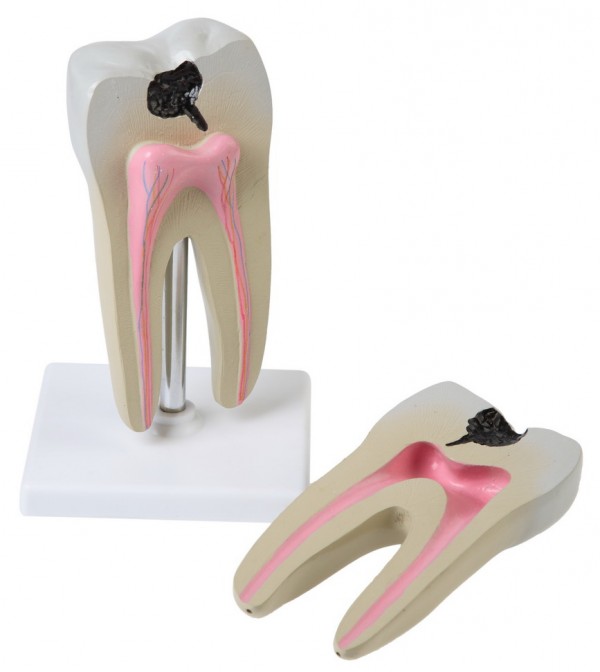 Модель коренного зуба